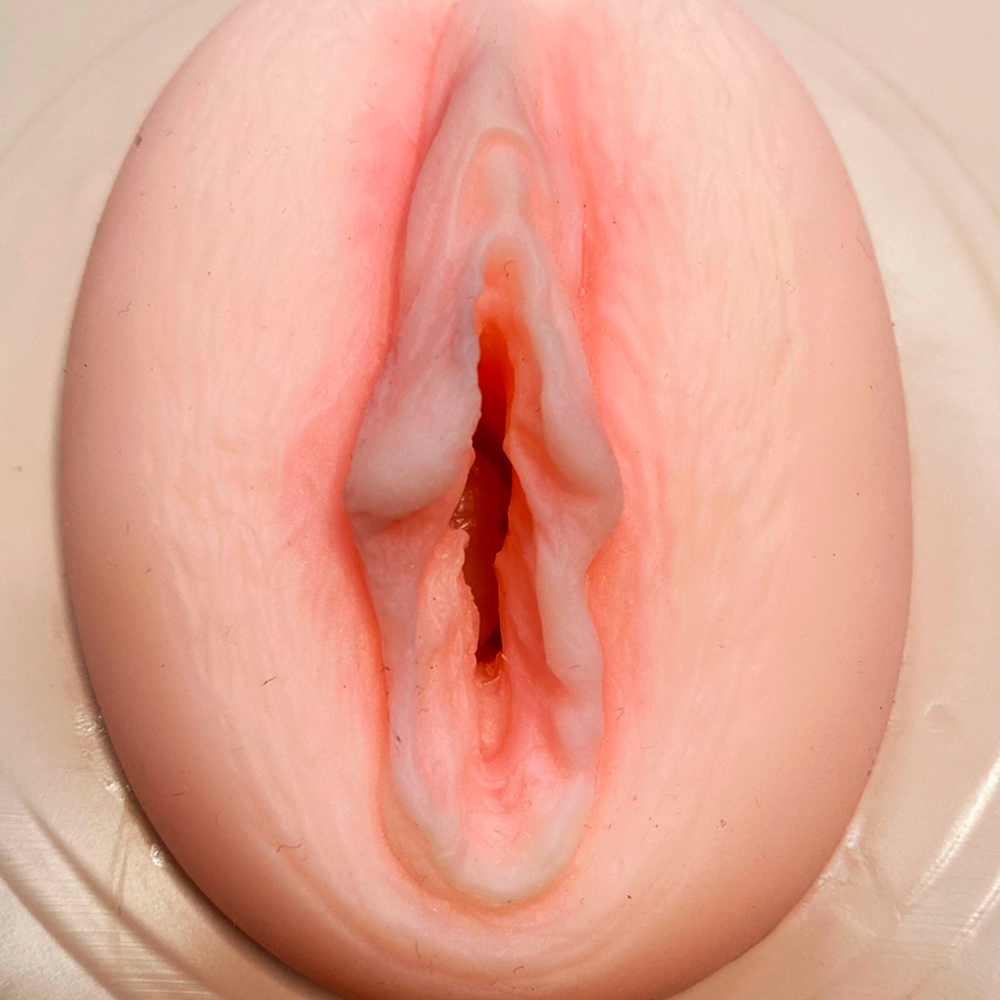 376